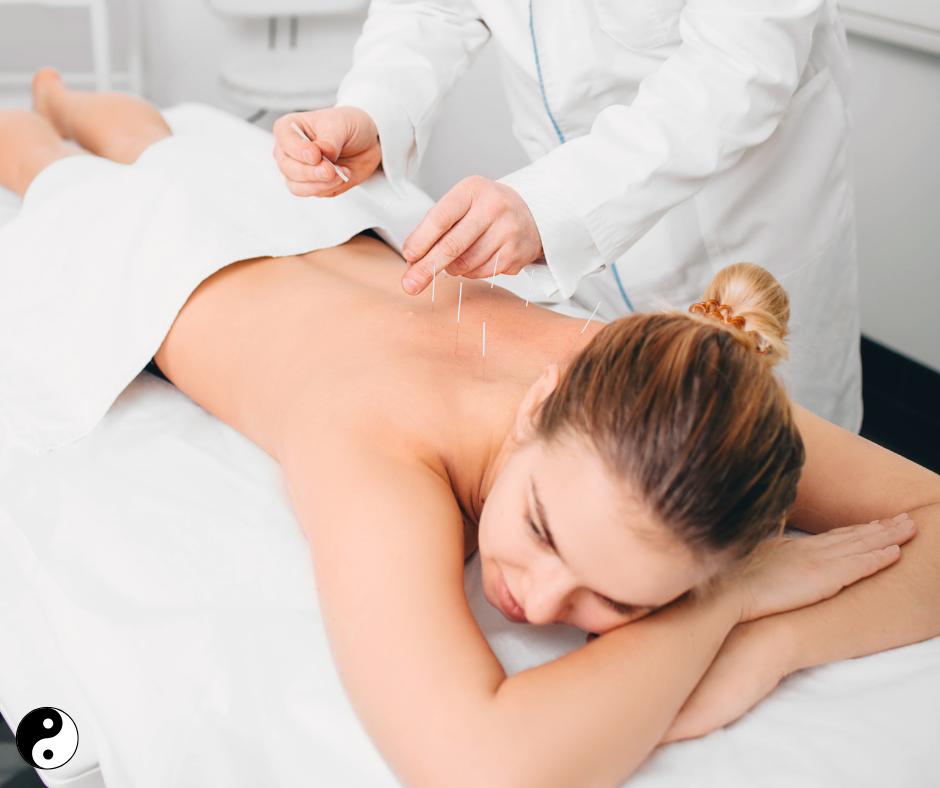 A serene acupuncture treatment room featuring a practitioner gently placing needles into a patient's back. The room is softly lit, adorned with traditional Chinese décor and calming natural elements, such as plants and water features for a peaceful ambiance.